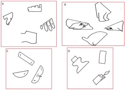 Mapping and Preserving the Visuospatial Network by repetitive nTMS and DTI Tractography in Patients With Right Parietal Lobe Tumors